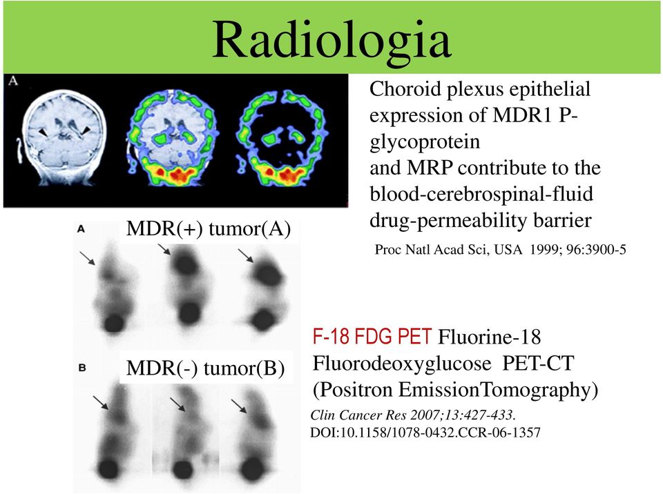 Sci, USA 1999; 96:3900-5 MDR(-) tumor(b) F-18 FDG PET Fluorine-18 Fluorodeoxyglucose PET-CT