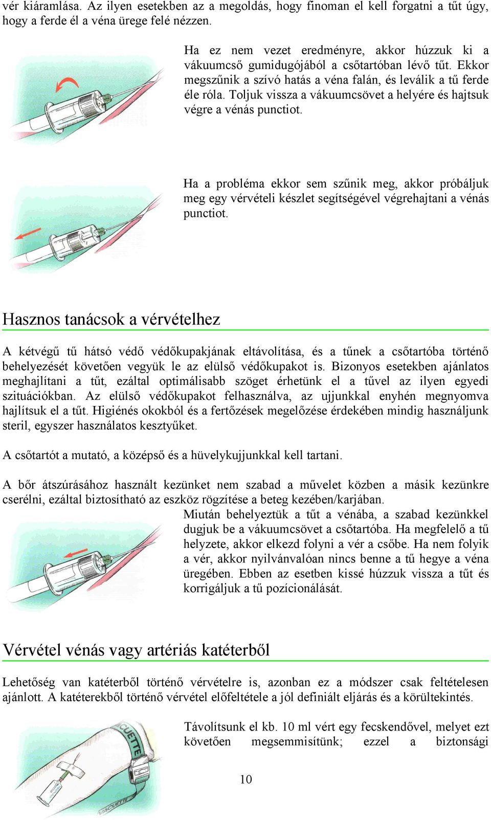 Toljuk vissza a vákuumcsövet a helyére és hajtsuk végre a vénás punctiot. Ha a probléma ekkor sem szűnik meg, akkor próbáljuk meg egy vérvételi készlet segítségével végrehajtani a vénás punctiot.