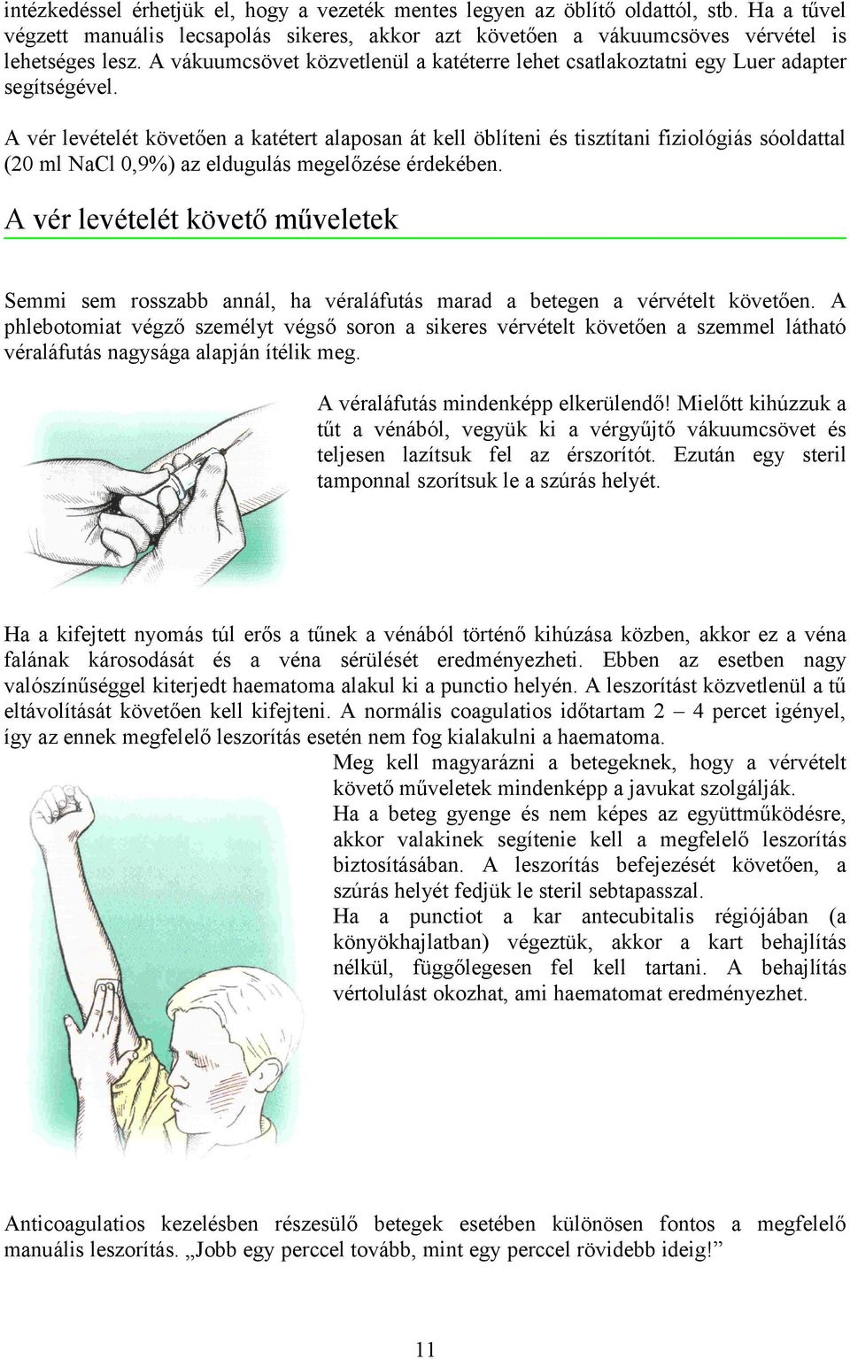 A vér levételét követően a katétert alaposan át kell öblíteni és tisztítani fiziológiás sóoldattal (20 ml NaCl 0,9%) az eldugulás megelőzése érdekében.