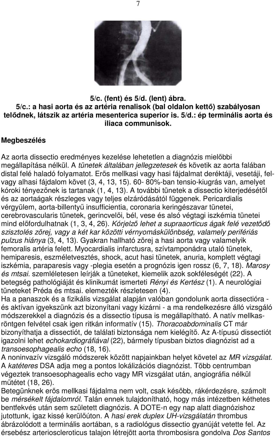 Erıs mellkasi vagy hasi fájdalmat deréktáji, vesetáji, felvagy alhasi fájdalom követ (3, 4, 13, 15). 60-80%-ban tensio-kiugrás van, amelyet kóroki tényezınek is tartanak (1, 4, 13).