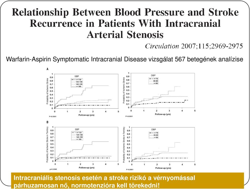 Intracraniális stenosis esetén a stroke rizikó