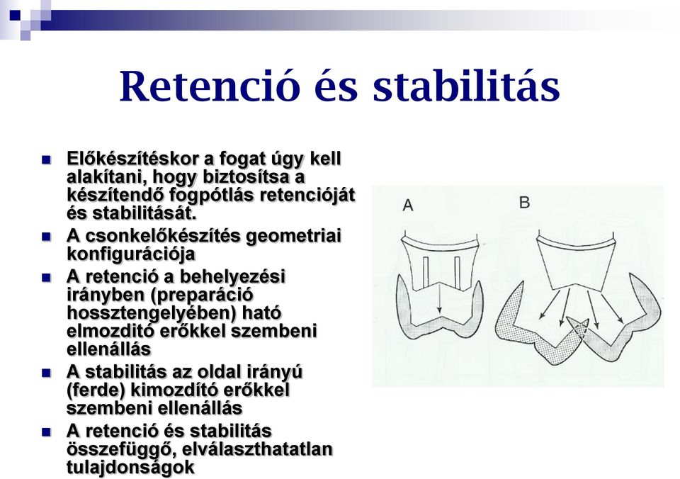 A csonkelőkészítés geometriai konfigurációja A retenció a behelyezési irányben (preparáció