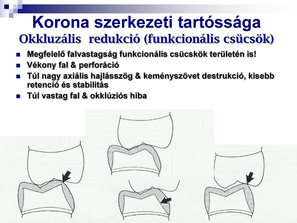 Vékony fal & perforáció Túl nagy axiális hajlásszög & keményszövet