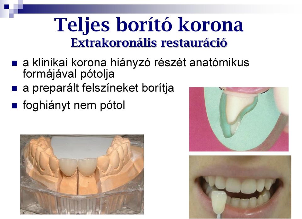részét anatómikus formájával pótolja a