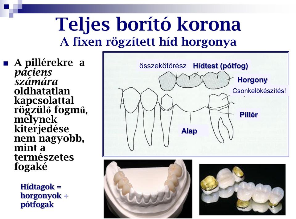 kiterjedése nem nagyobb, mint a természetes fogaké összekötőrész
