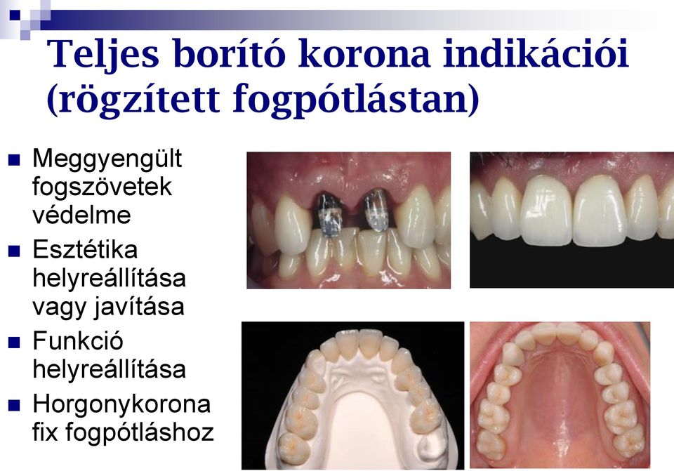 Esztétika helyreállítása vagy javítása