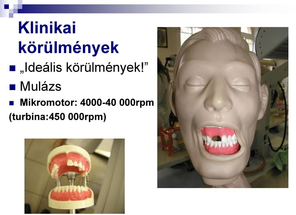 Mulázs Mikromotor:
