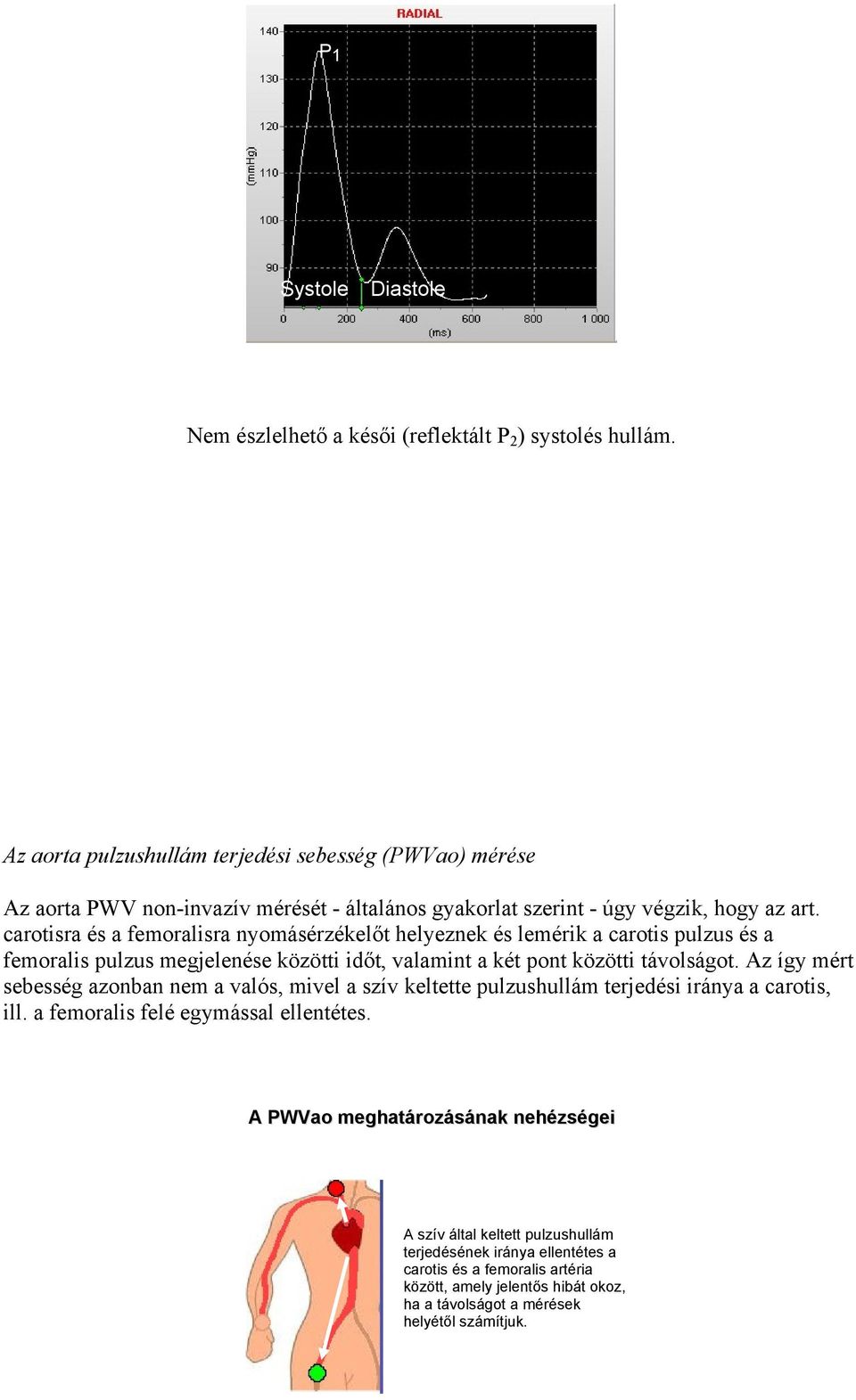 carotisra és a femoralisra nyomásérzékelőt helyeznek és lemérik a carotis pulzus és a femoralis pulzus megjelenése közötti időt, valamint a két pont közötti távolságot.