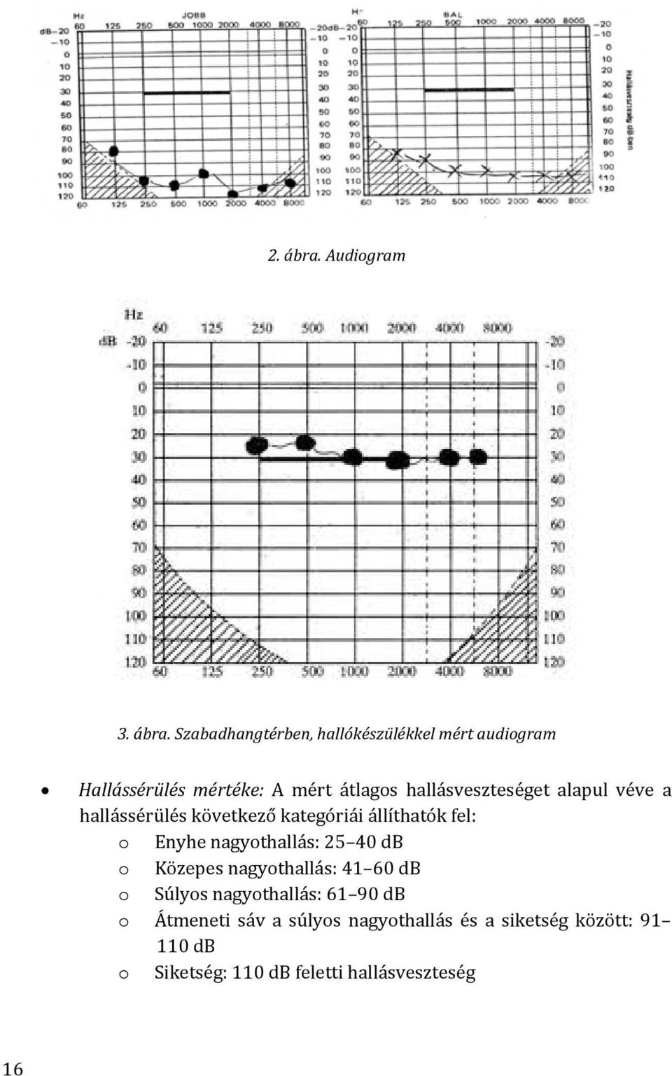 Szabadhangtérben, hallókészülékkel mért audiogram Hallássérülés mértéke: A mért átlagos