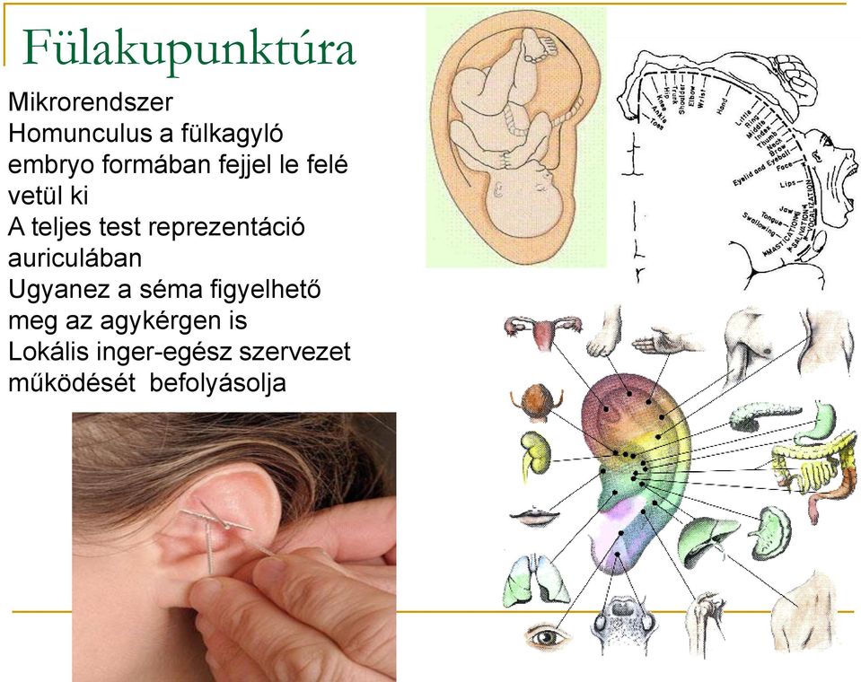 reprezentáció auriculában Ugyanez a séma figyelhető meg