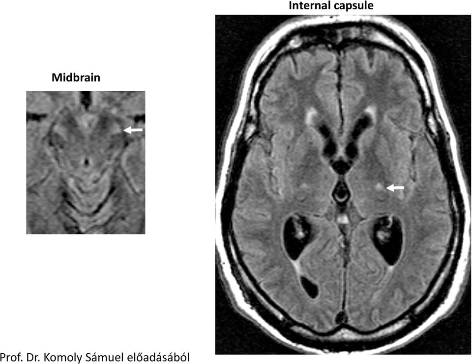 Midbrain Prof.