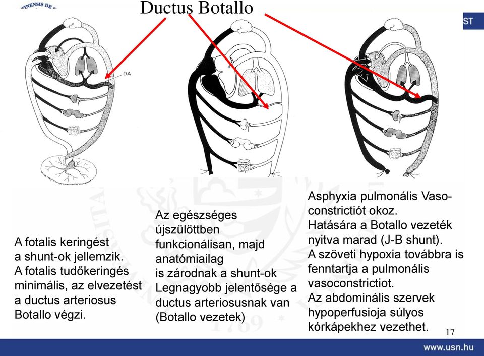 Az egészséges újszülöttben funkcionálisan, majd anatómiailag is zárodnak a shunt-ok Legnagyobb jelentősége a ductus arteriosusnak