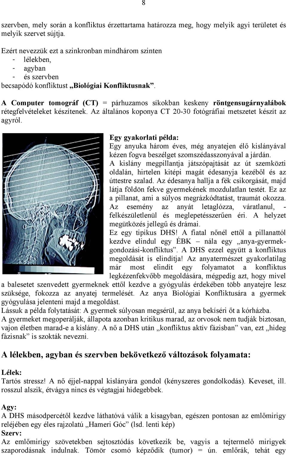 A Computer tomográf (CT) = párhuzamos síkokban keskeny röntgensugárnyalábok rétegfelvételeket készítenek. Az általános koponya CT 20-30 fotógráfiai metszetet készít az agyról.