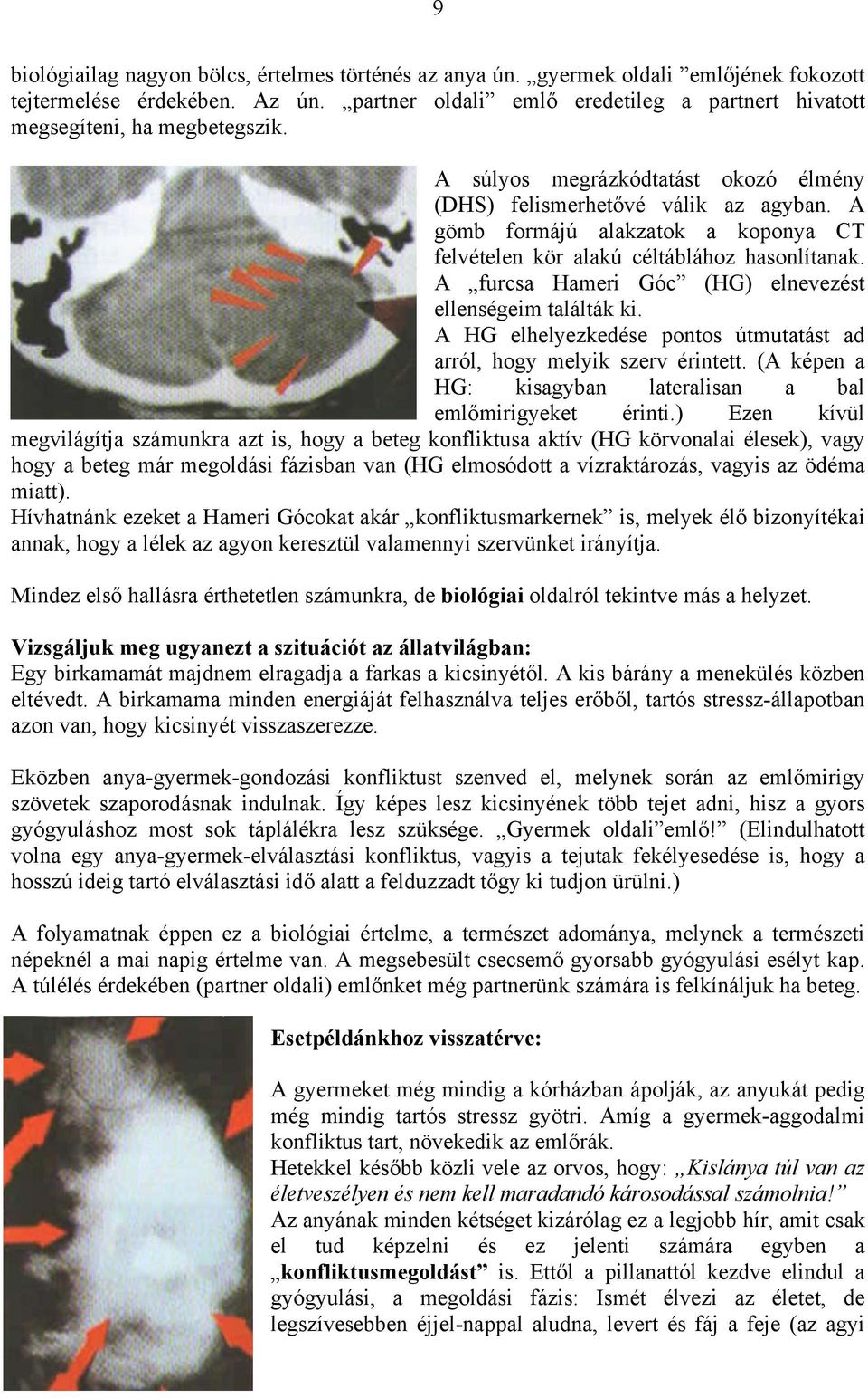 A gömb formájú alakzatok a koponya CT felvételen kör alakú céltáblához hasonlítanak. A furcsa Hameri Góc (HG) elnevezést ellenségeim találták ki.