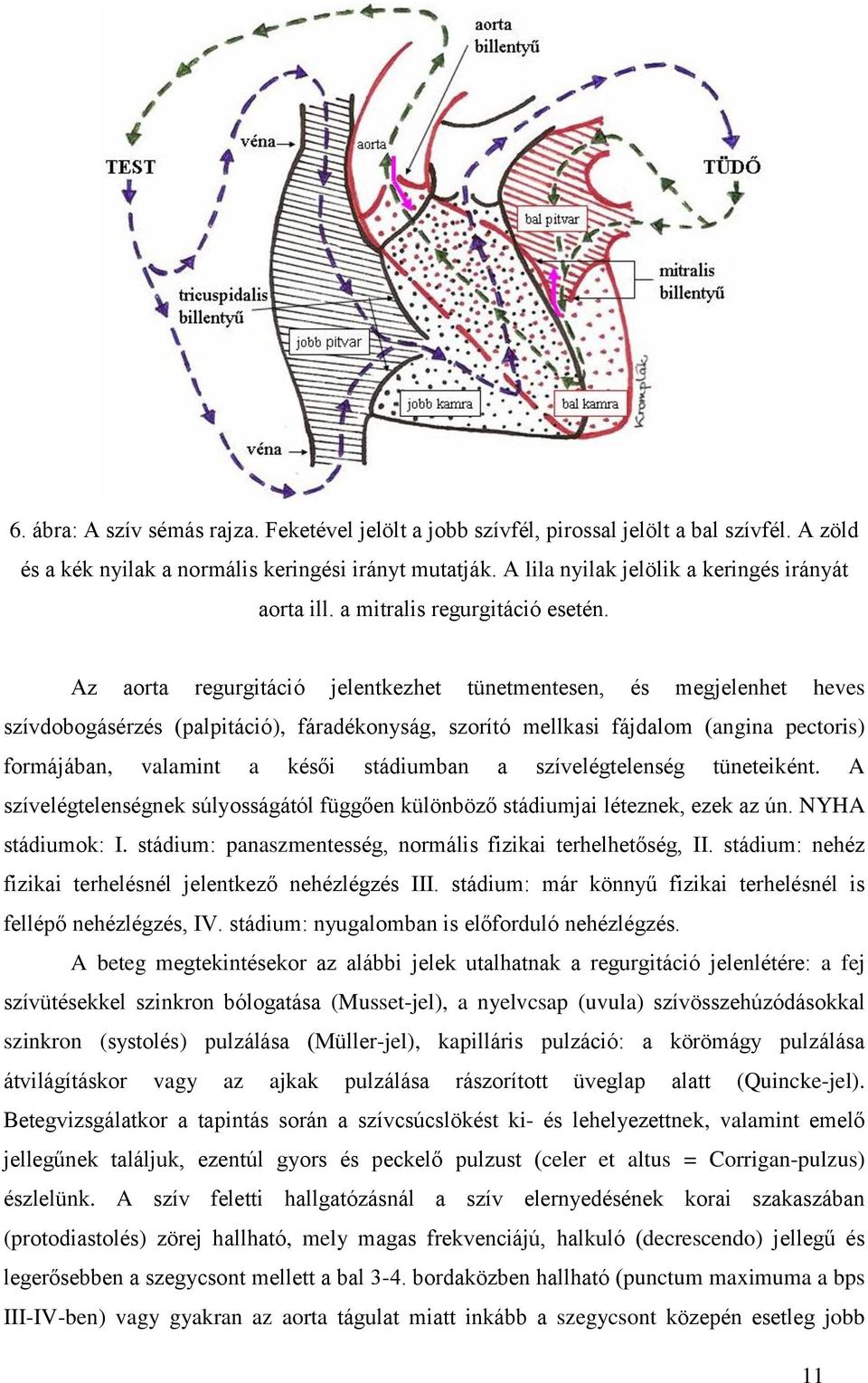 Az aorta regurgitáció jelentkezhet tünetmentesen, és megjelenhet heves szívdobogásérzés (palpitáció), fáradékonyság, szorító mellkasi fájdalom (angina pectoris) formájában, valamint a késői