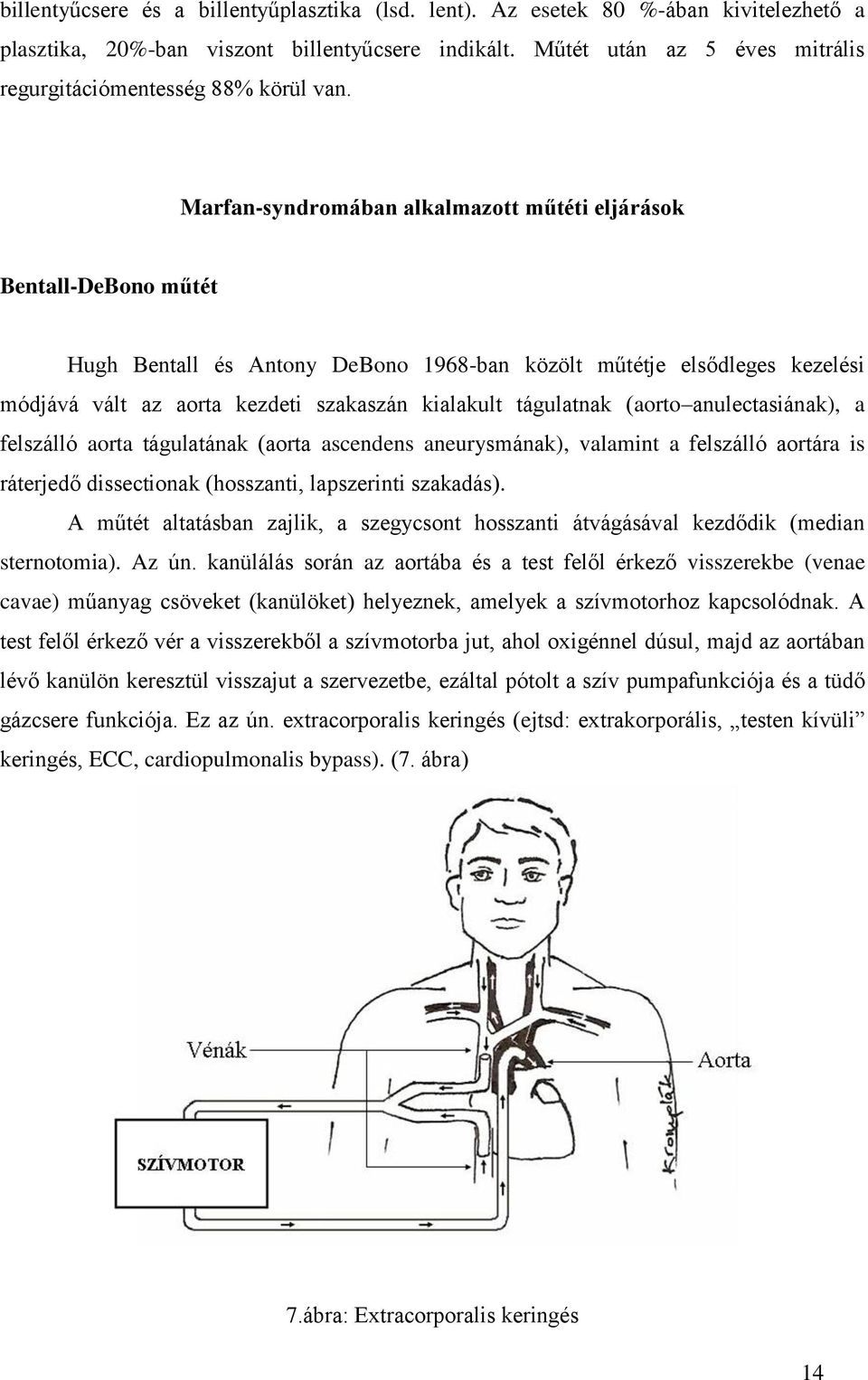 Marfan-syndromában alkalmazott műtéti eljárások Bentall-DeBono műtét Hugh Bentall és Antony DeBono 1968-ban közölt műtétje elsődleges kezelési módjává vált az aorta kezdeti szakaszán kialakult