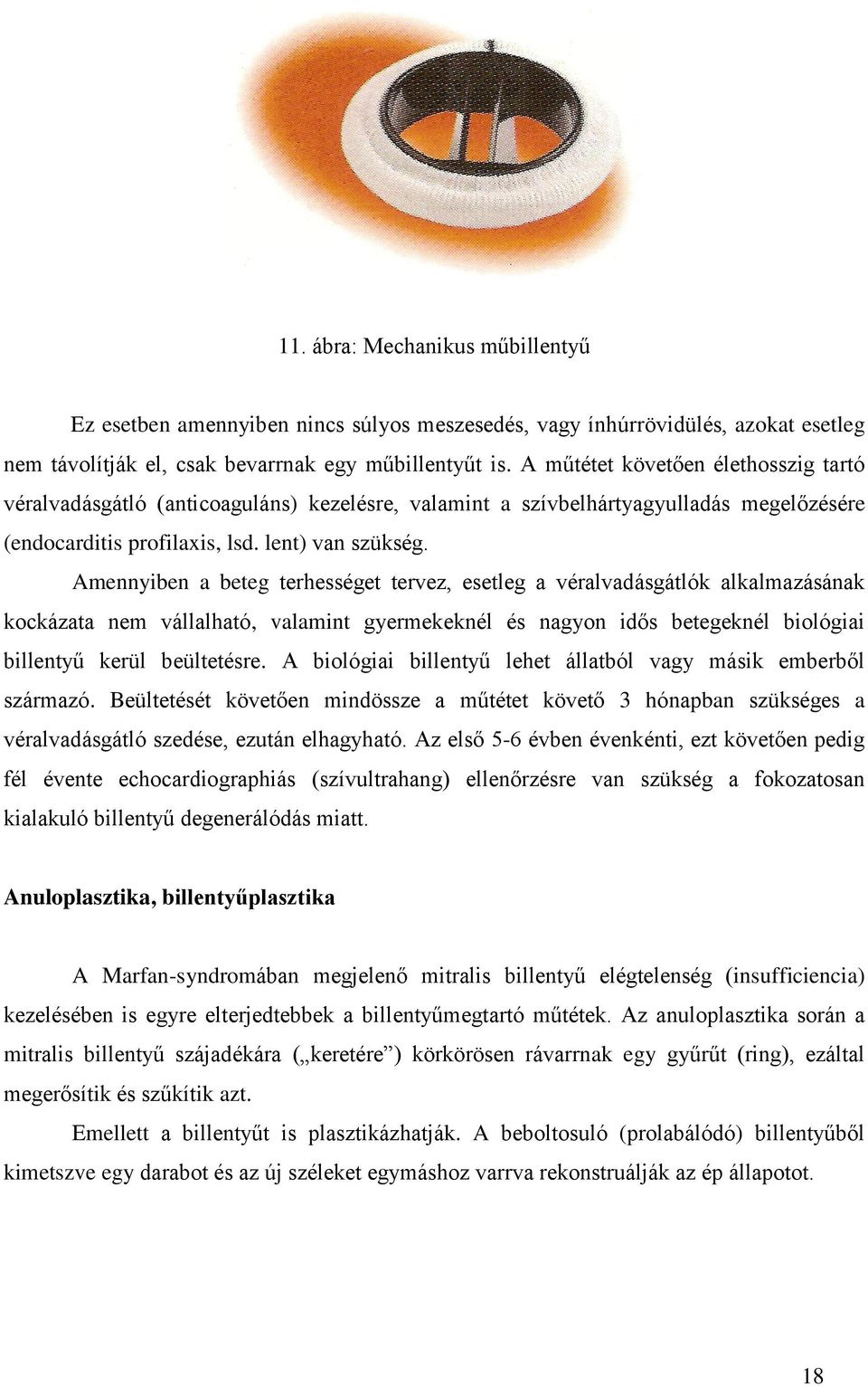 Amennyiben a beteg terhességet tervez, esetleg a véralvadásgátlók alkalmazásának kockázata nem vállalható, valamint gyermekeknél és nagyon idős betegeknél biológiai billentyű kerül beültetésre.