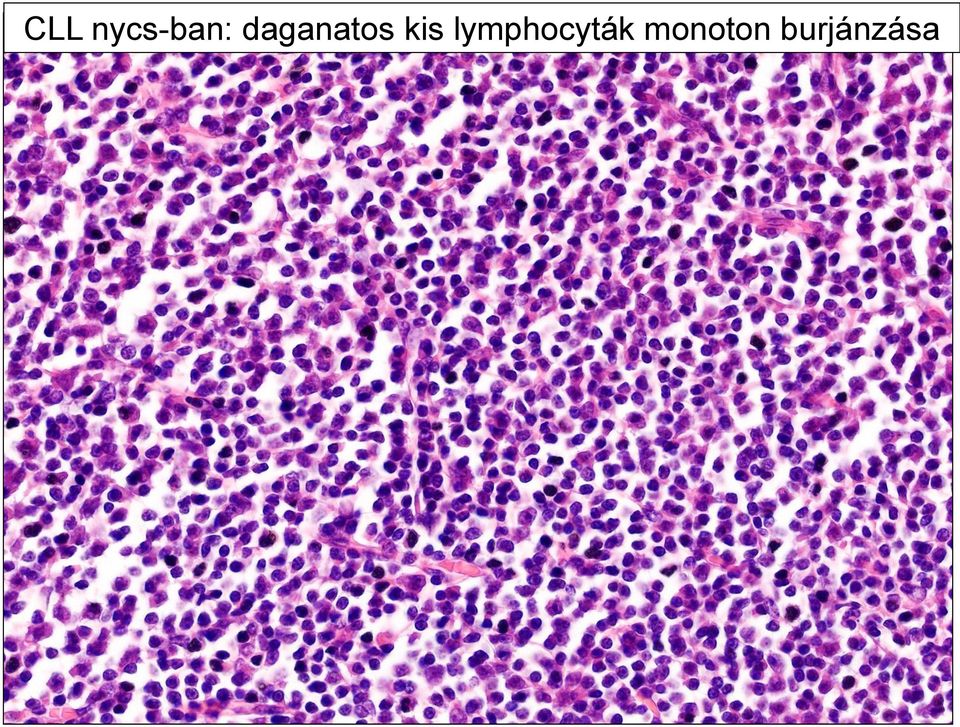 lymphocyták