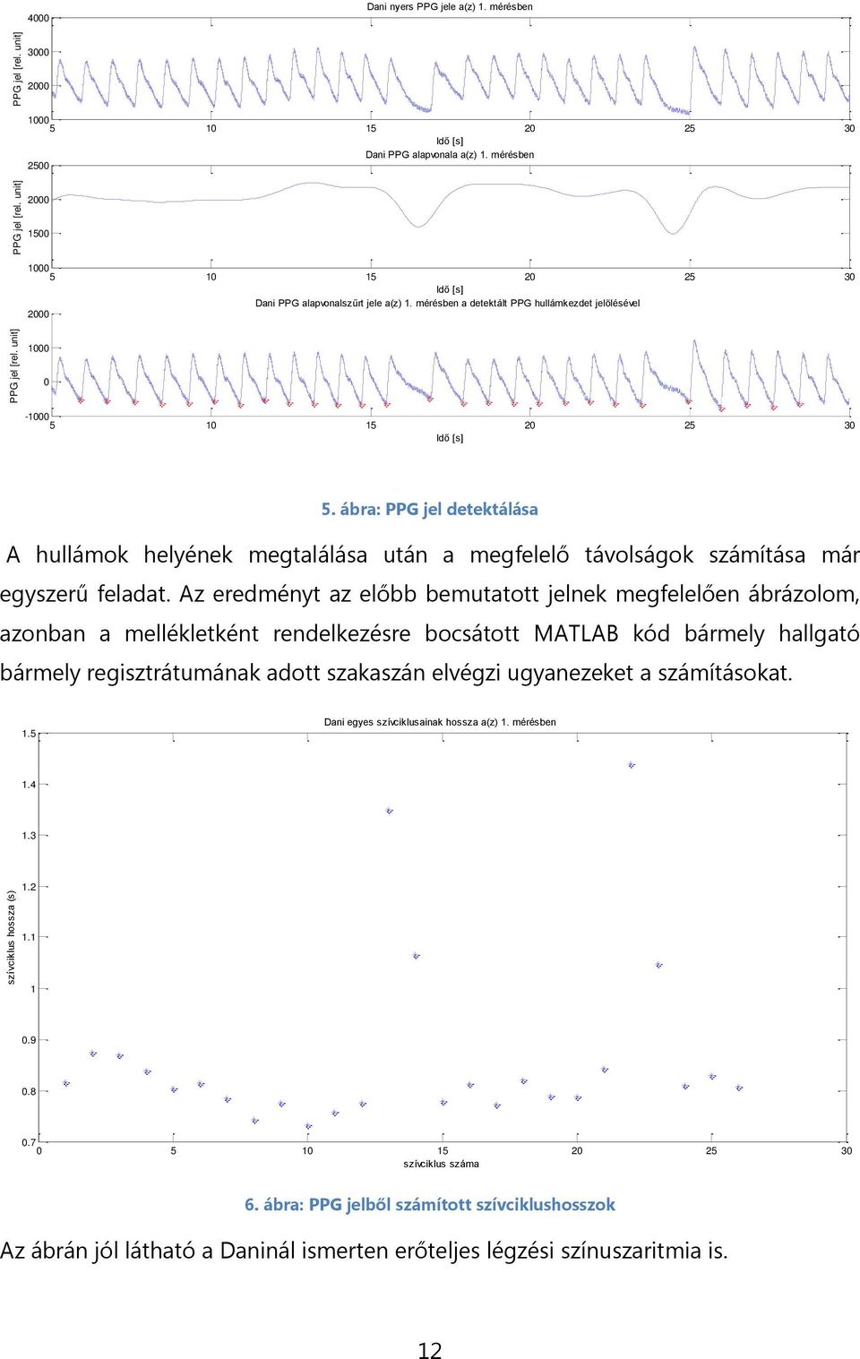 ábra: PPG jel detektálása A hullámok helyének megtalálása után a megfelelő távolságok számítása már egyszerű feladat.