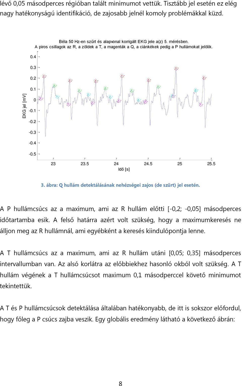 5 24 24.5 25 25.5 Idő [s] 3. ábra: Q hullám detektálásának nehézségei zajos (de szűrt) jel esetén. A P hullámcsúcs az a maximum, ami az R hullám előtti [-,2; -,5] másodperces időtartamba esik.