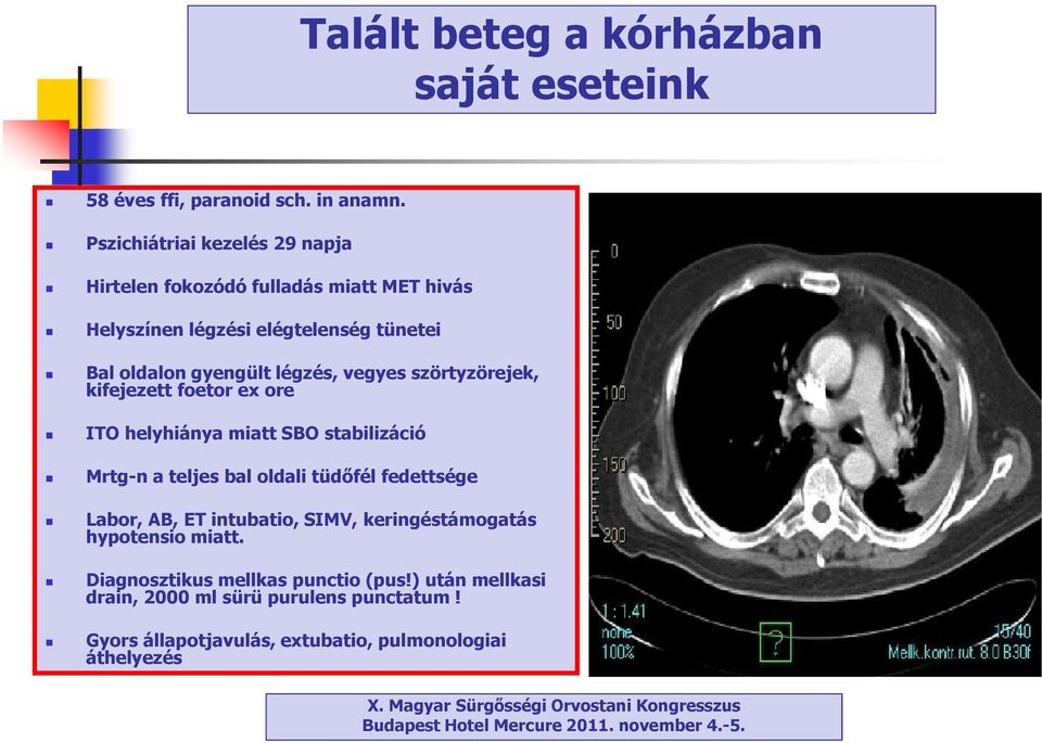 légzés, vegyes szörtyzörejek, kifejezett foetor ex ore ITO helyhiánya miatt SBO stabilizáció Mrtg-n a teljes bal oldali tüdőfél fedettsége