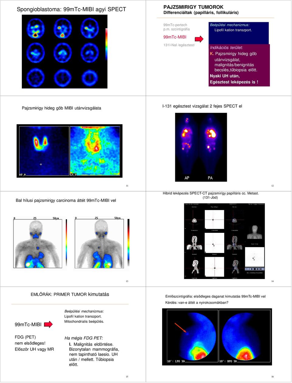 Pajzsmirigy hideg göb MIBI utánvizsgálata I-131 egésztest vizsgálat 2 fejes SPECT el Pertechnetát MIBI 11 Országos Onkológiai Intézet 12 Bal hílusi pajzsmirigy carcinoma áttét 99mTc-MIBI vel Hibrid