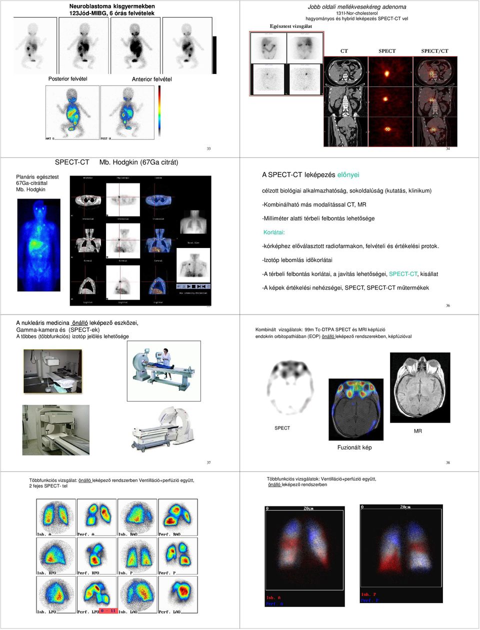 Hodgkin (67Ga citrát) A SPECT-CT leképezés előnyei célzott biológiai alkalmazhatóság, sokoldalúság (kutatás, klinikum) -Kombinálható más modalitással CT, MR -Milliméter alatti térbeli felbontás