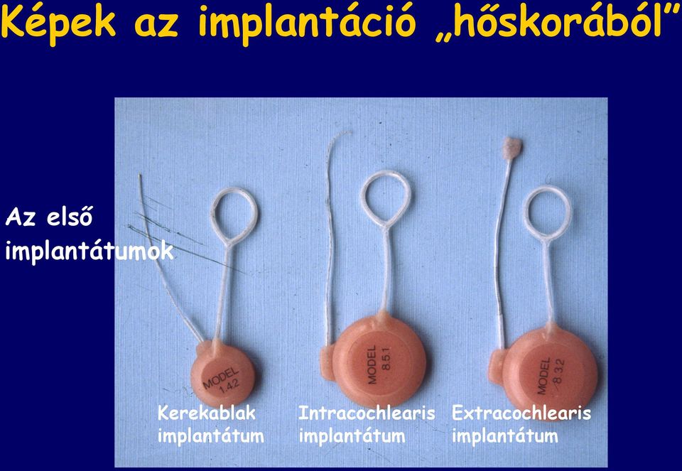 implantátum Intracochlearis