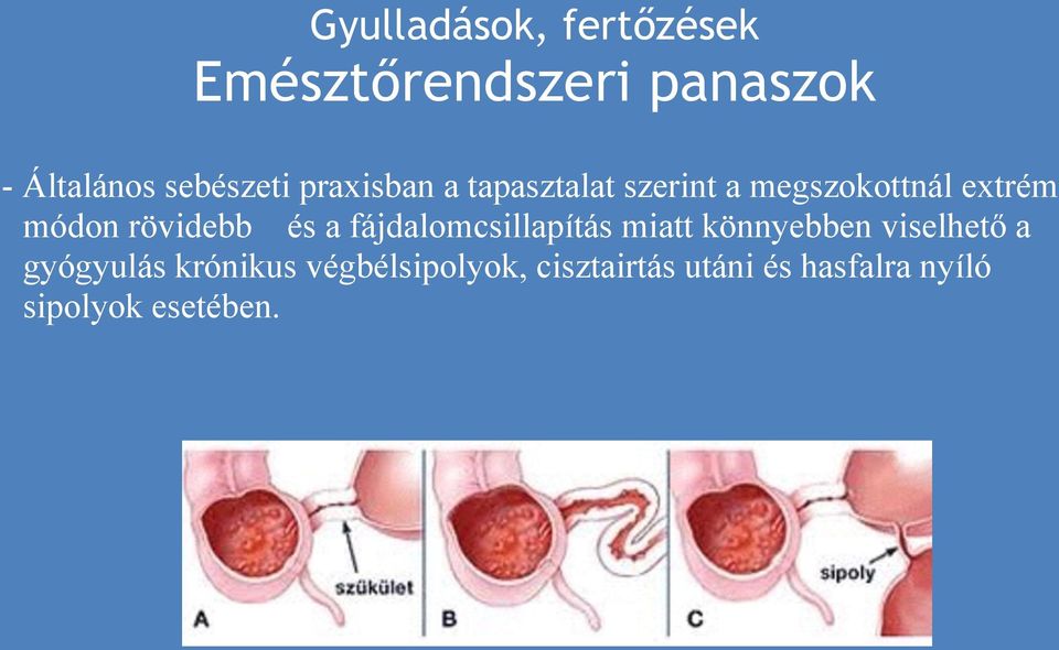 és a fájdalomcsillapítás miatt könnyebben viselhető a gyógyulás