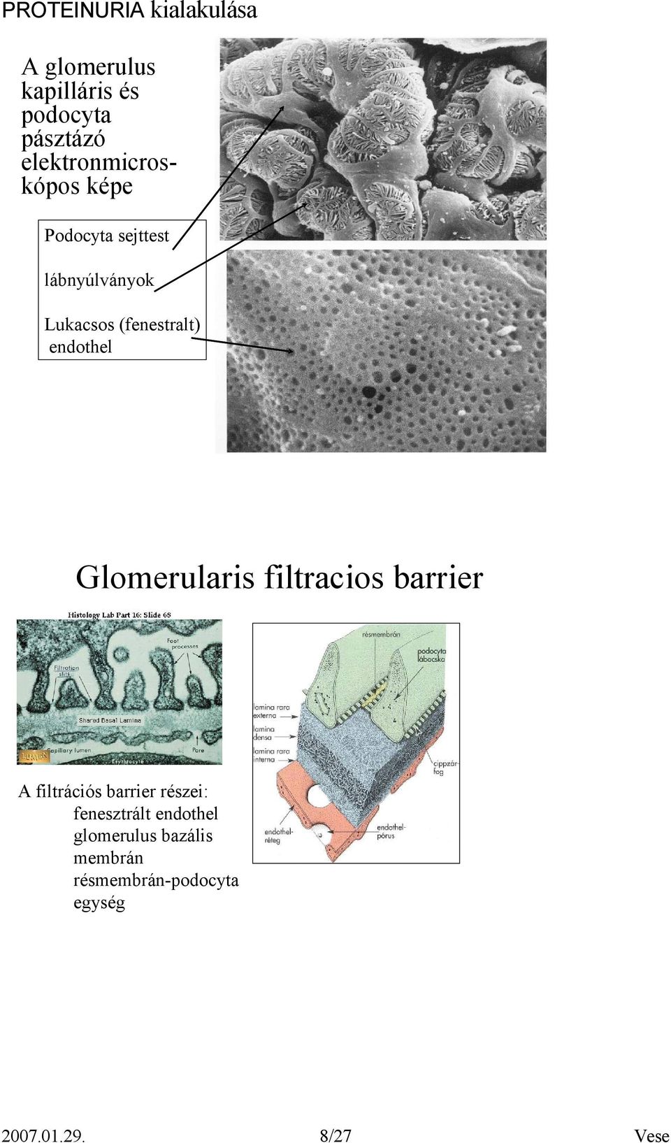 (fenestralt) endothel Glomerularis filtracios barrier A filtrációs barrier