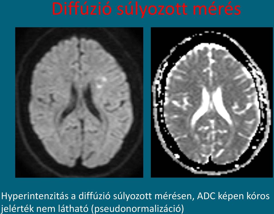 súlyozott mérésen, ADC képen