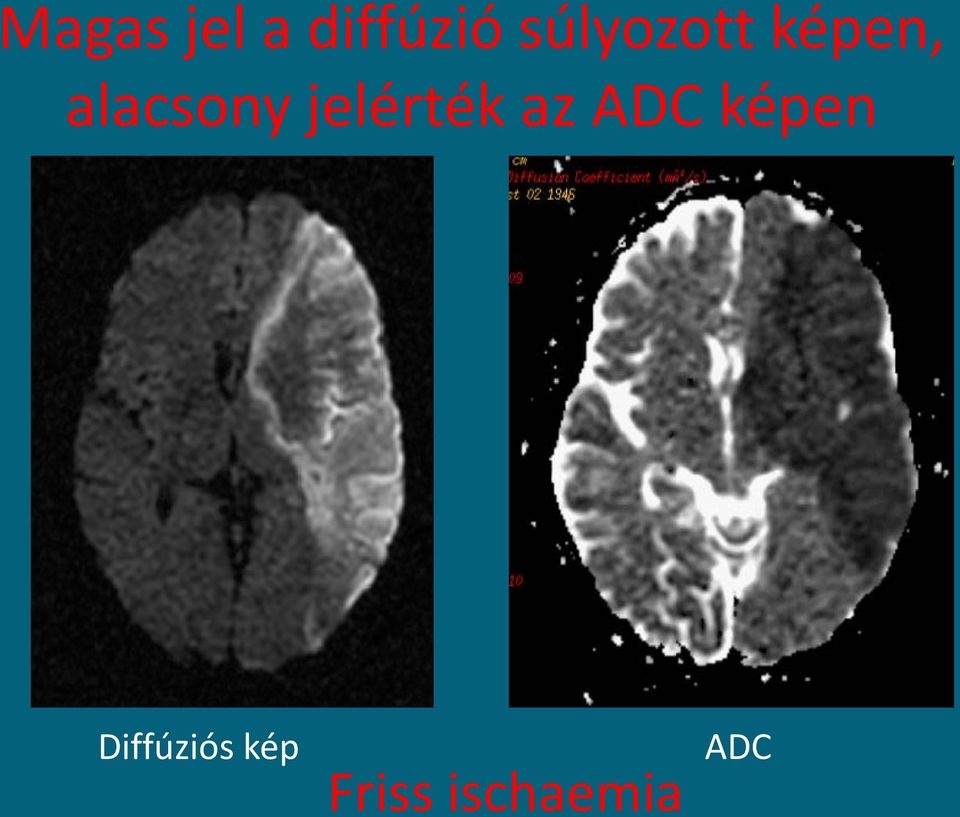 jelérték az ADC képen