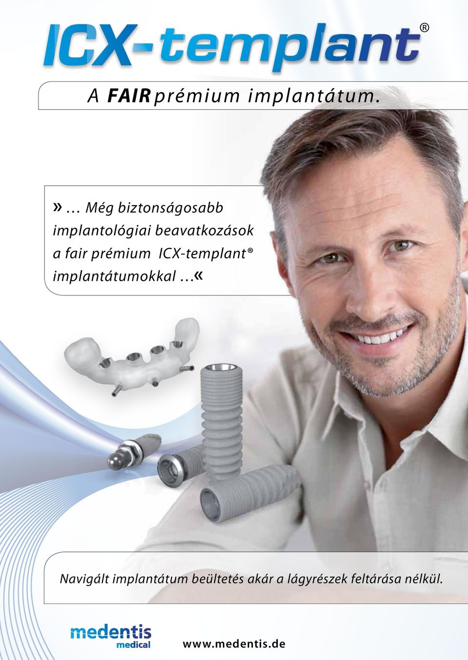 prémium ICX-templant implantátumokkal «Navigált implantátum