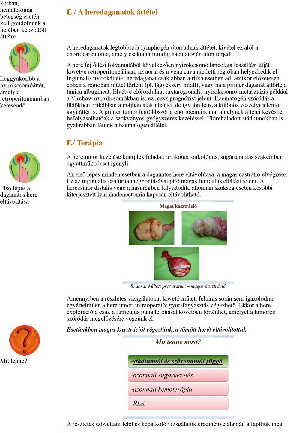 A here fejlődési folyamatából következően nyirokcsomó láncolata leszállási útját követve retroperitoneálisan, az aorta és a vena cava melletti régióban helyezkedik el.