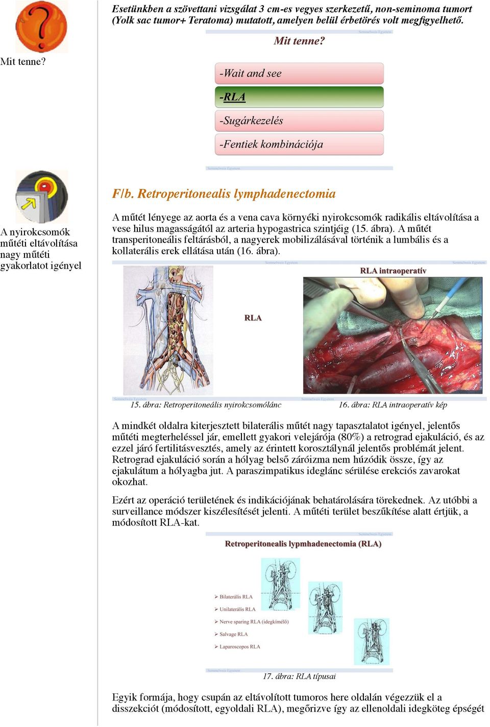 magasságától az arteria hypogastrica szintjéig (15. ábra). A műtét transperitoneális feltárásból, a nagyerek mobilizálásával történik a lumbális és a kollaterális erek ellátása után (16. ábra). 15.