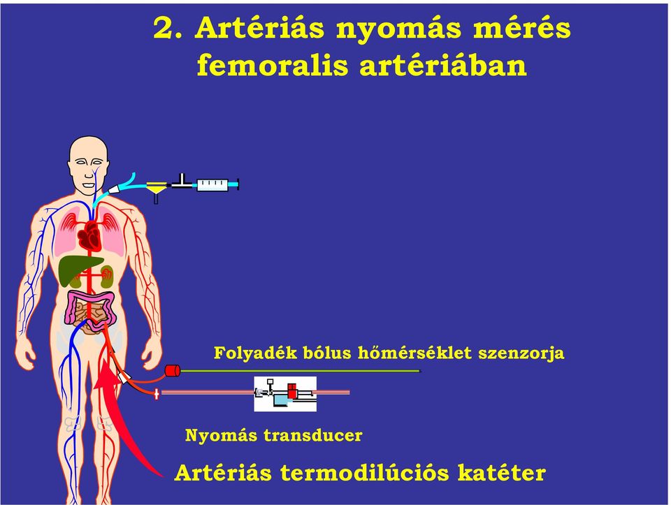 bólus hőmérséklet szenzorja