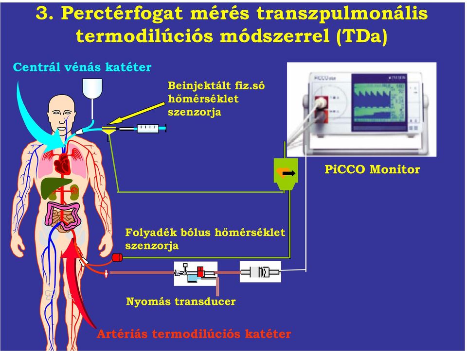 só hőmérséklet szenzorja PiCCO Monitor Folyadék bólus