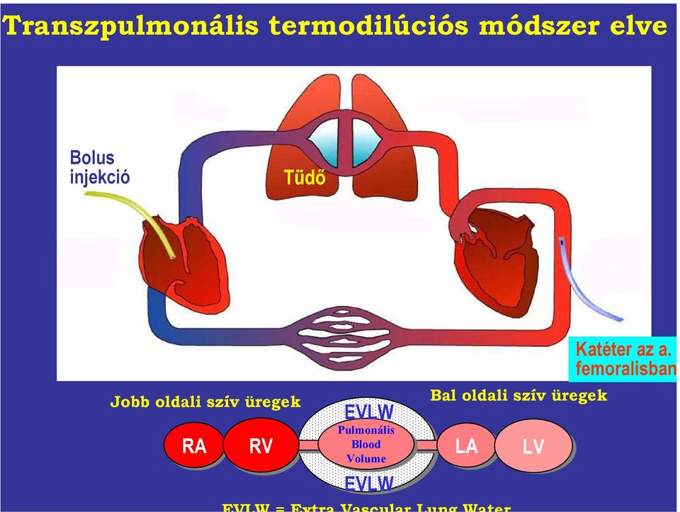 RA RV EVLW Pulmonális Blood Volume EVLW Bal