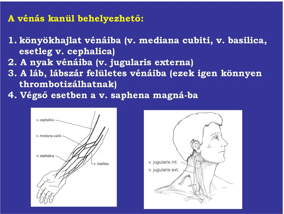 A nyak vénáiba (v. jugularis externa) 3.