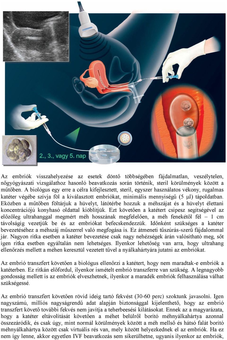 Eközben a műtőben föltárjuk a hüvelyt, látótérbe hozzuk a méhszájat és a hüvelyt élettani koncentrációjú konyhasó oldattal kiöblítjük.