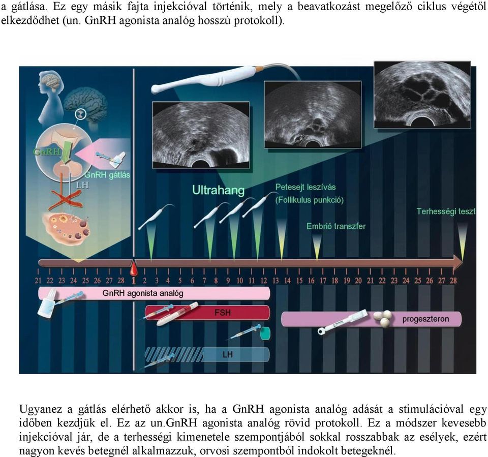 Ugyanez a gátlás elérhető akkor is, ha a GnRH agonista analóg adását a stimulációval egy időben kezdjük el. Ez az un.