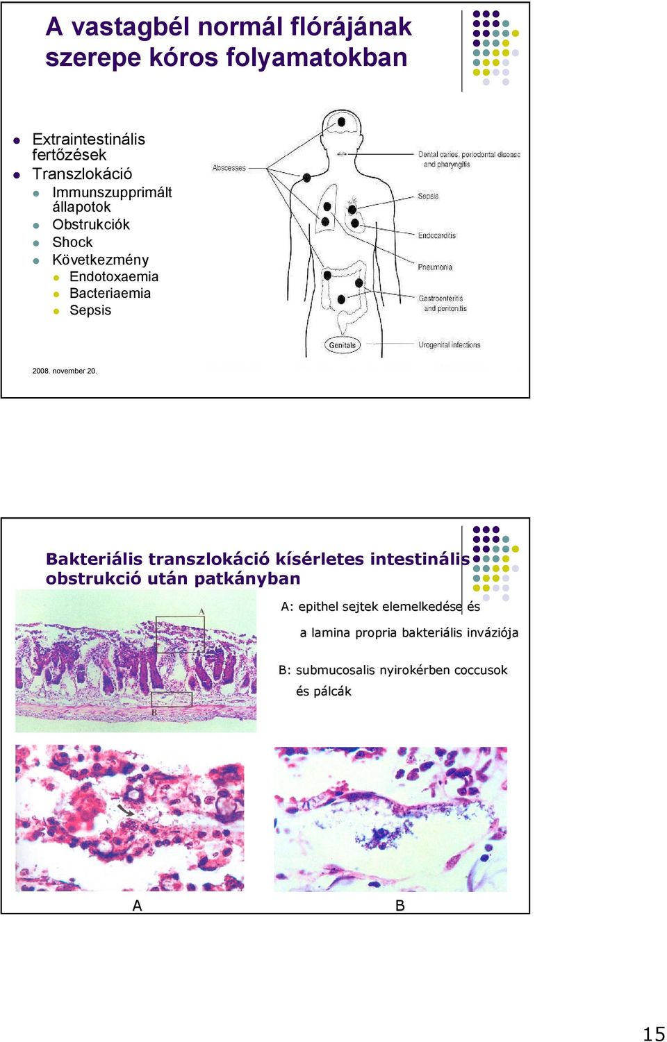 29 Bakteriális transzlokáció kísérletes intestinális obstrukció után patkányban A: epithel sejtek elemelkedése és