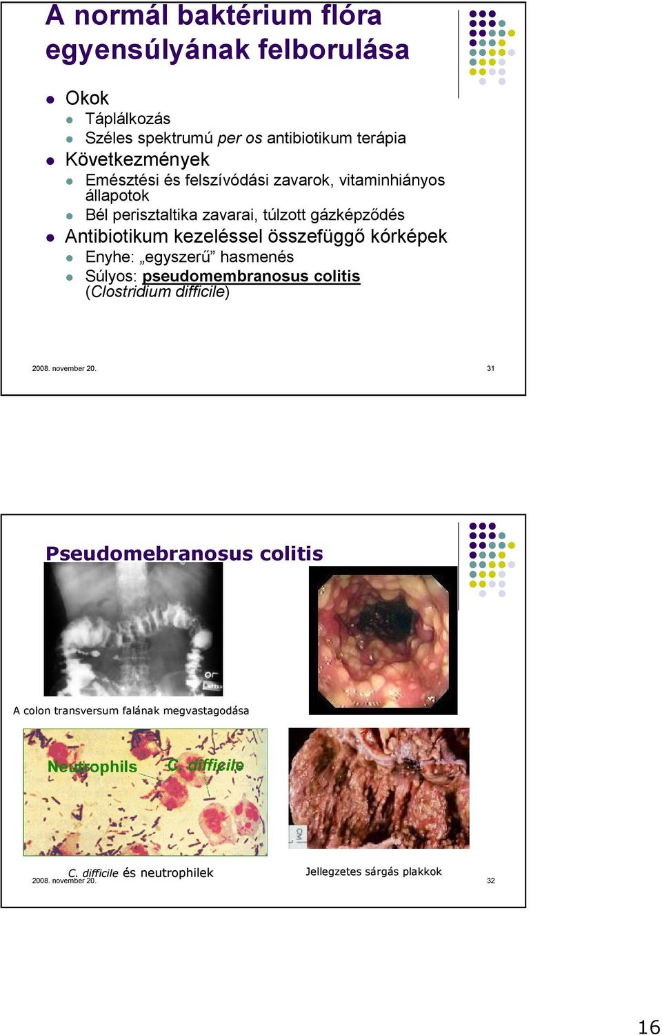 kórképek Enyhe: egyszerő hasmenés Súlyos: pseudomembranosus colitis (Clostridium difficile) 2008. november 20.