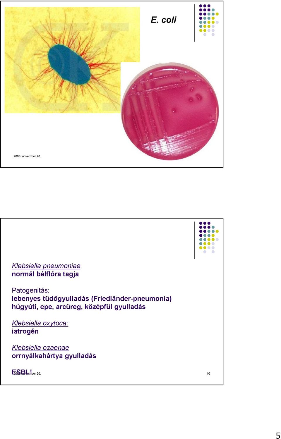 tüdıgyulladás (Friedländer-pneumonia) húgyúti, epe, arcüreg, középfül