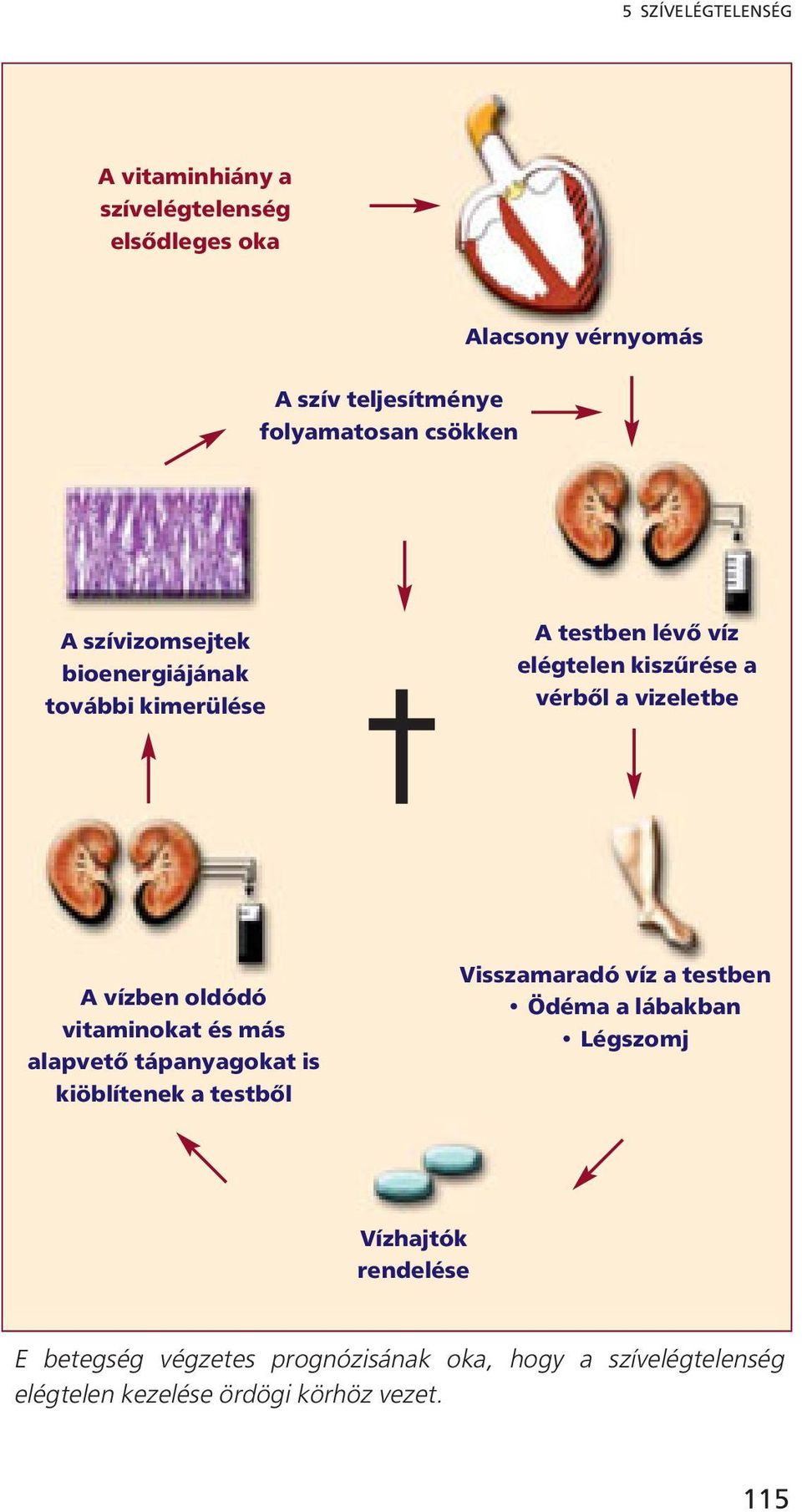 vízben oldódó vitaminokat és más alapvető tápanyagokat is kiöblítenek a testből Visszamaradó víz a testben Ödéma a lábakban