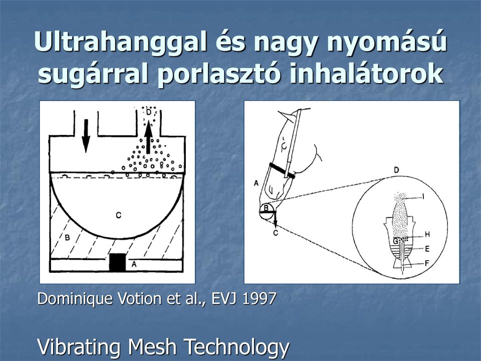 inhalátorok Dominique Votion