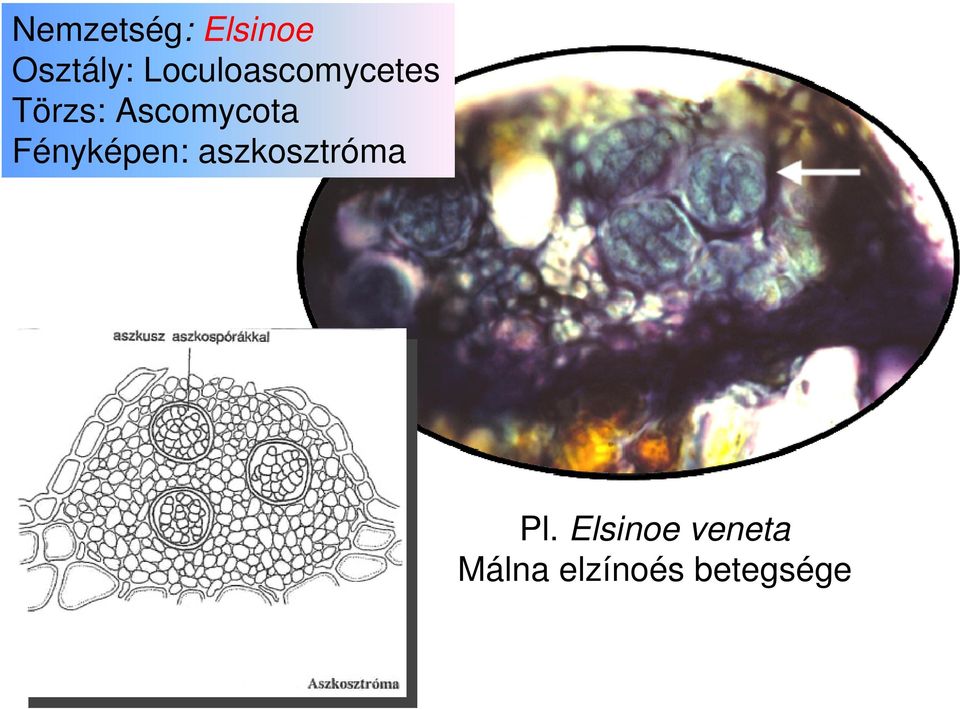 Ascomycota Fényképen: