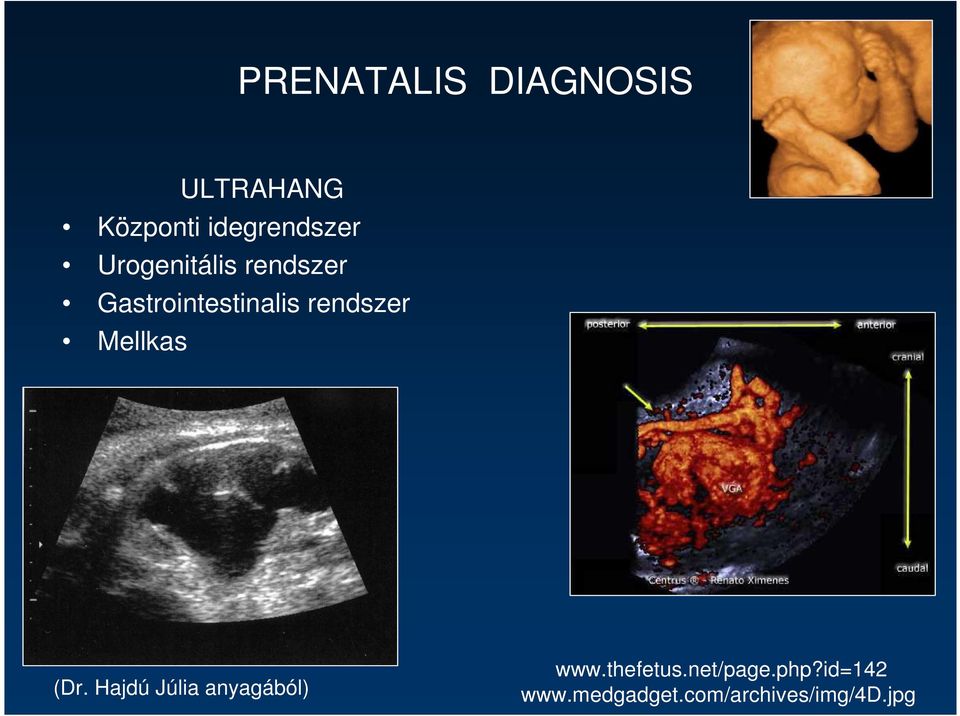 Mellkas (Dr. Hajdú Júlia anyagából) www.thefetus.