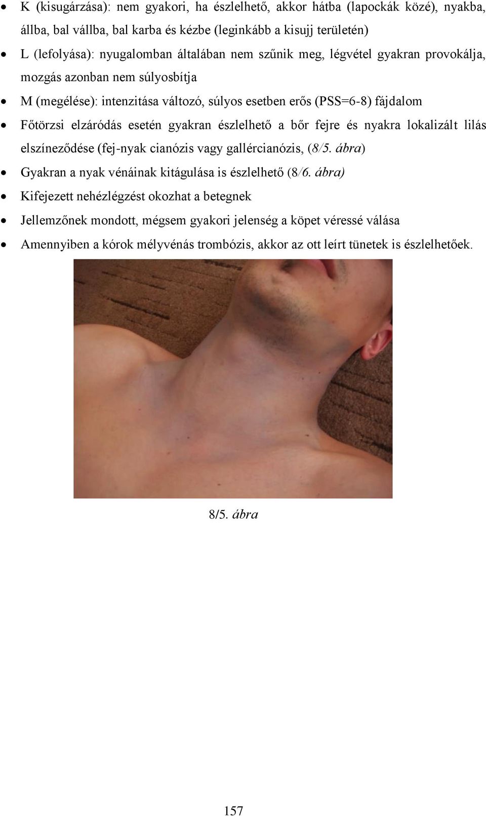 észlelhető a bőr fejre és nyakra lokalizált lilás elszíneződése (fej-nyak cianózis vagy gallércianózis, (8/5. ábra) Gyakran a nyak vénáinak kitágulása is észlelhető (8/6.