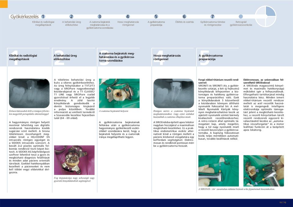 csatorna bejáratok meghatározása és a gyökércsatorna szondázása 4Hossz meghatározás röntgennel 5A gyökércsatorna preparációja Erősen károsodott őrlő a röntgen felvételen megjelölt periapikális